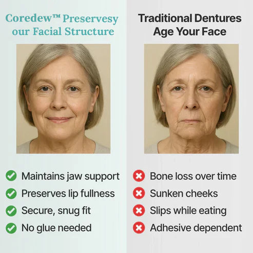 ✨Ends Today: 50% OFF! Coredew™⏰ Custom-Fit Full Functional Dentures Make you more confident